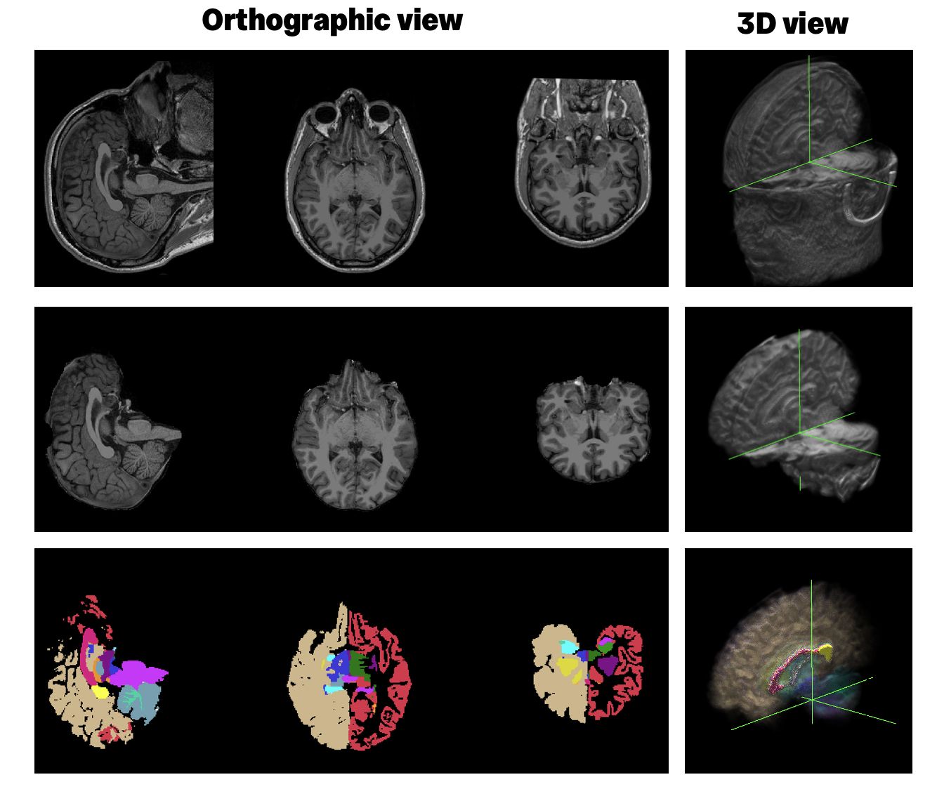 Input Freesurfer images: T1, brain, and aseg